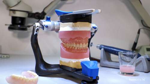 3D打印数字义齿